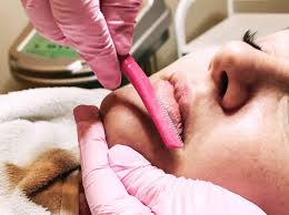 Derma Blading
