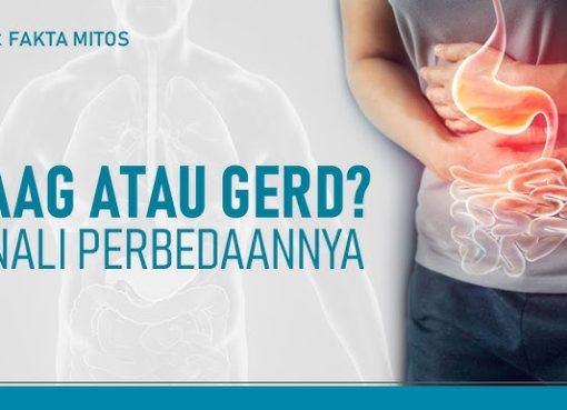 GERD vs Maag: Solusi Sehat dan Alami tanpa Bergantung Obat