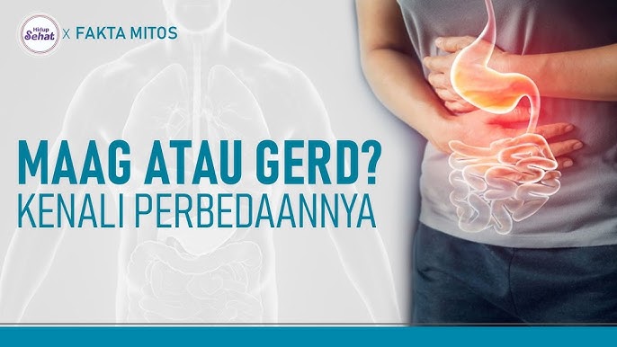 GERD vs Maag: Solusi Sehat dan Alami tanpa Bergantung Obat