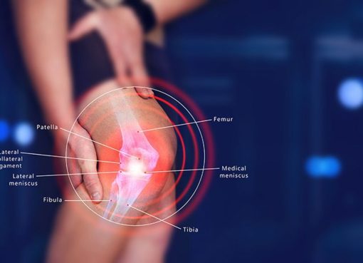 Cedera Ligamen