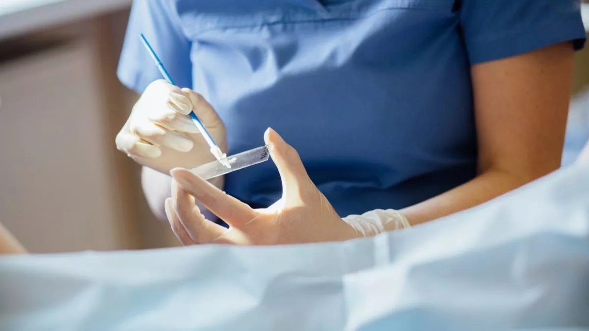 Tes Pap Smear