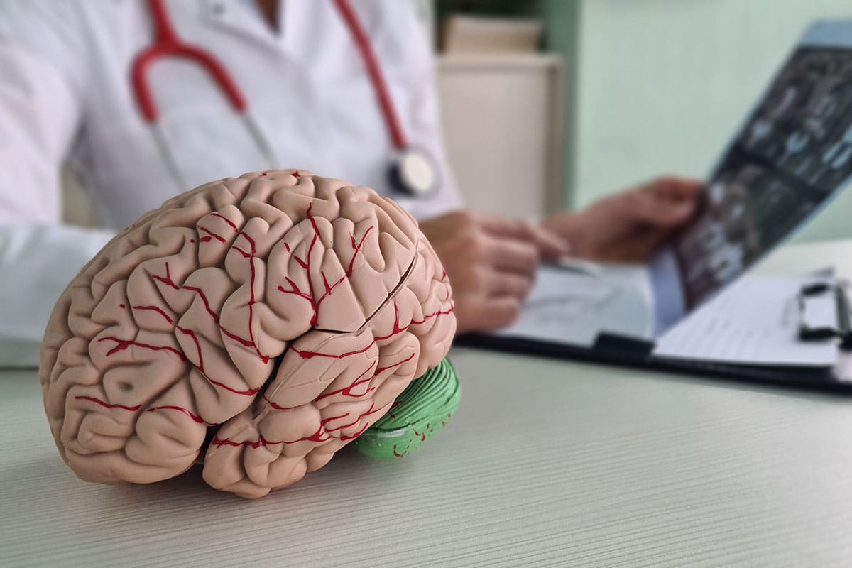 Gejala Stroke Iskemik yang Harus Diwaspadai